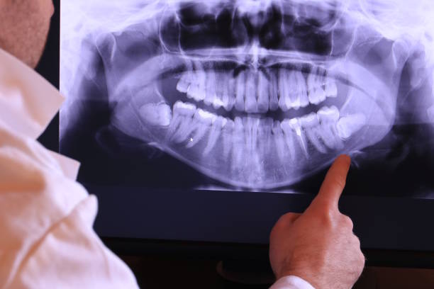Best Emergency Dental Care for Abscessed Tooth in Rockport, TX
